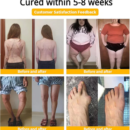 Bee-Venom Pain-Relief Bone Healing Cream (Buy 1 Get 1 Free)